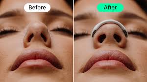 Magnetic Nasal Strips